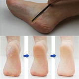 Dead Skin Planer